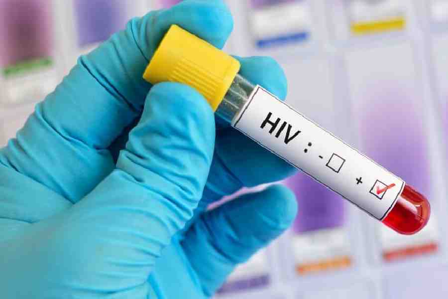 NLC commits R124m to tackle HIV and tuberculosis in South Africa